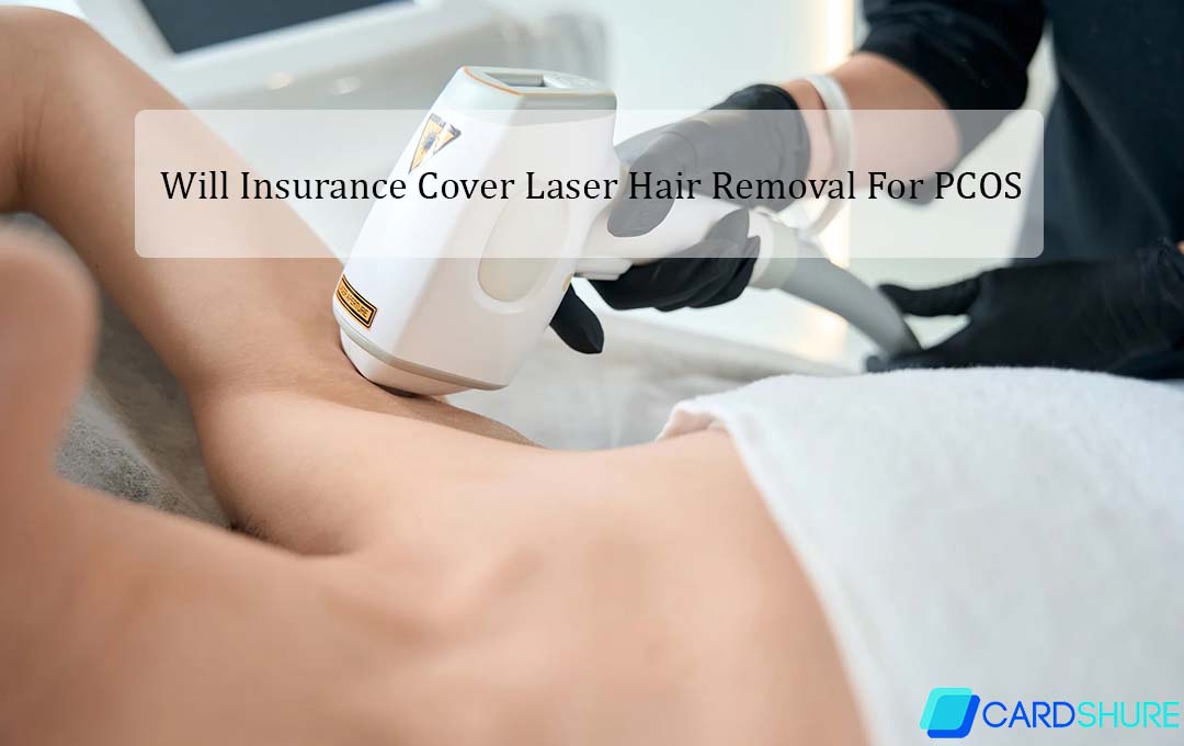 Will Insurance Cover Laser Hair Removal For PCOS